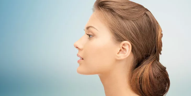 rhinoplasty