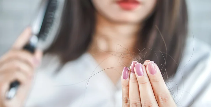 Female Hair Loss