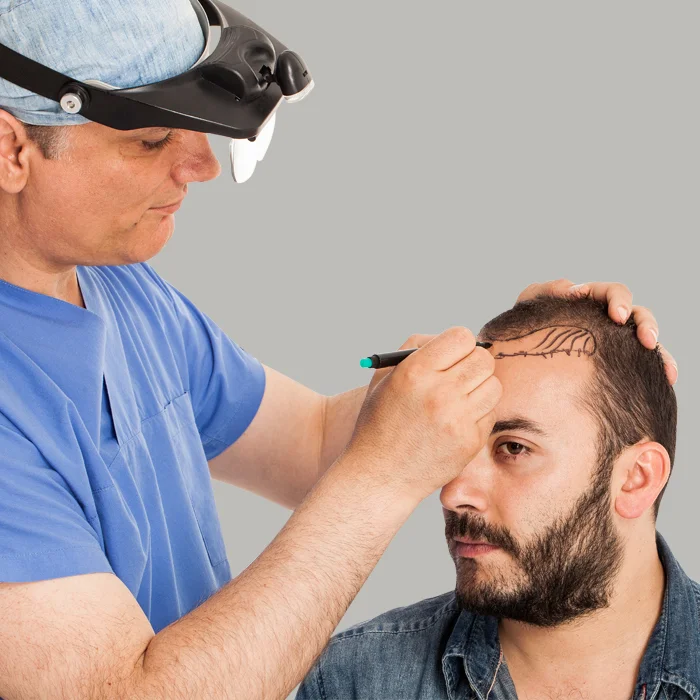 Bio-DHT Hair restoration