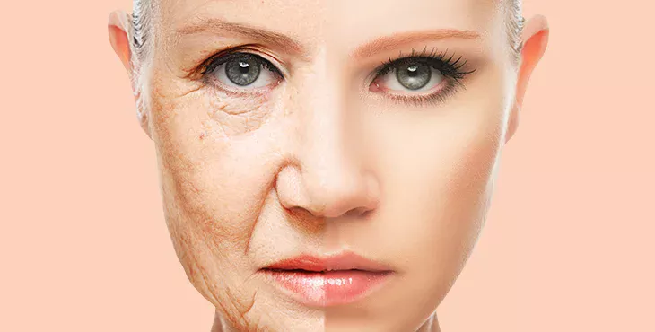 Anti aging fillers