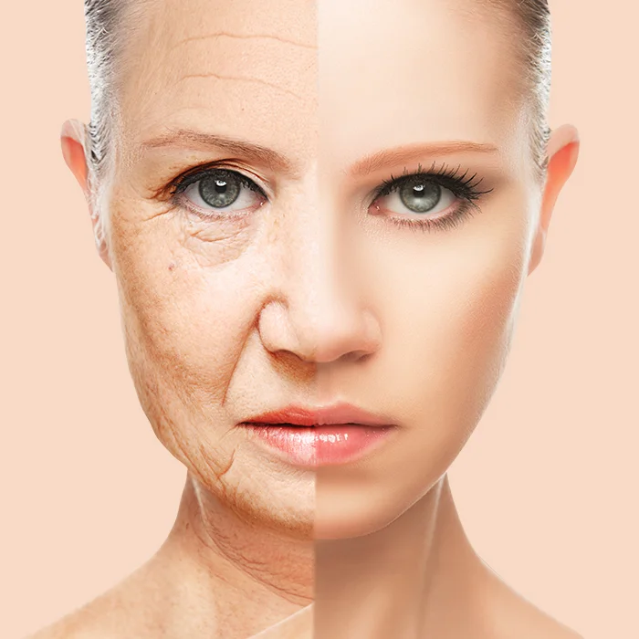 Anti Aging Fillers